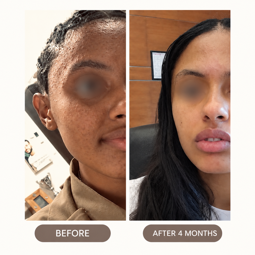 Turmeric + Kojic Brightening Bar